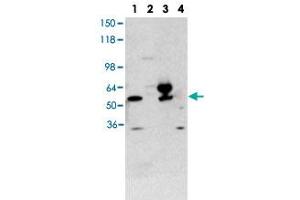 Western blot using THRA polyclonal antibody  shows detection of purified recombinant THRA (lane 1) and THRA present in a 293 cell lysate after transient transfection with THRA (lane 3). (THRA 抗体  (N-Term))