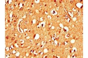 Immunohistochemistry of paraffin-embedded human brain tissue using ABIN7170837 at dilution of 1:100 (Stim2 抗体  (AA 471-656))