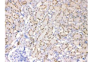 IHC analysis of ADK using anti- ADK antibody . (ADK 抗体  (AA 165-351))
