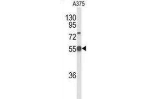 Western Blotting (WB) image for anti-delta Like Protein 3 (DLL3) antibody (ABIN2926345) (DLL3 抗体)
