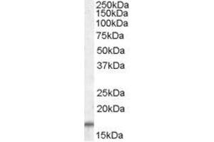 Image no. 1 for anti-Cytochrome C Oxidase Subunit IV Isoform 1 (COX4I1) (C-Term), (Isoform 1), (Isoform 2) antibody (ABIN401531) (COX IV 抗体  (C-Term, Isoform 1, Isoform 2))