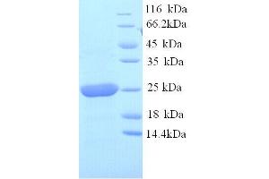 alpha 1 Microglobulin/bikunin (AMBP) (AA 20-203), (full length) protein (His tag)