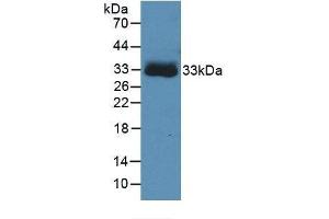 Detection of Recombinant CA4, Human using Monoclonal Antibody to Carbonic Anhydrase IV (CA4) (CA4 抗体  (AA 19-283))