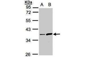 WB Image Sample(30 ug whole cell lysate) A:HeLa S3, B:Raji , 10% SDS PAGE antibody diluted at 1:1000 (PRSS8 抗体  (Center))