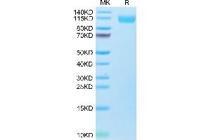 SDS-PAGE (SDS) image for SARS-CoV-2 Spike S1 (B.1.1.529 - Omicron) protein (His-Avi Tag,Biotin) (ABIN7274405)