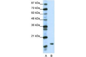 WB Suggested Anti-DR1 Antibody Titration:  1.