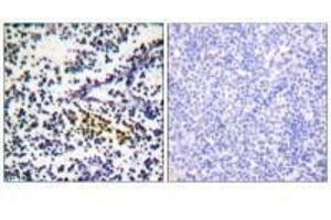 Immunohistochemistry analysis of paraffin-embedded human tonsil tissue using NYREN18 antibody. (NUB1 抗体  (C-Term))