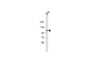 Anti-ROBO1 Antibody at 1:2000 dilution + ZF4 whole cell lysate Lysates/proteins at 20 μg per lane. (TEK 抗体  (N-Term))