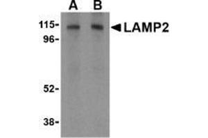 AP20058PU-N CD107b/LAMP2 antibody staining of HepG2 cell lysate by Western Blotting at (A) 1 and (B) 2 μg/ml.