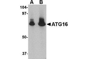 Western Blotting (WB) image for anti-ATG16 Autophagy Related 16-Like 1 (ATG16L1) (N-Term) antibody (ABIN1031245) (ATG16L1 抗体  (N-Term))