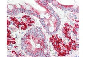 anti-Electron-Transfer-Flavoprotein, alpha Polypeptide (ETFA) (AA 276-304) antibody