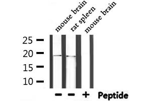 Western blot analysis of extracts from mouse brain,rat spleen, using UBE2I  Antibody. (UBE2I 抗体  (N-Term))