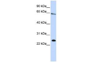 WB Suggested Anti-ZNF326 Antibody Titration:  0. (ZNF326 抗体  (N-Term))