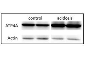 resentative western blot images of ATP4A, right panel is the quantification of the ratio of ATP4A on actin signals. (ATP4A 抗体  (AA 786-1014))