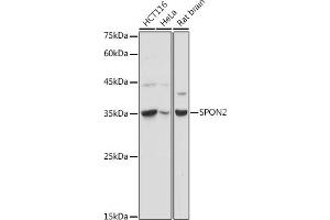 Western blot analysis of extracts of various cell lines, using SPON2 antibody (ABIN6129679, ABIN6148370, ABIN6148372 and ABIN6215647) at 1:1000 dilution. (SPON2 抗体  (AA 27-150))