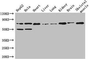 Western Blot Positive WB detected in: HepG2 whole cell lysate, Hela whole cell lysate, Mouse heart tissue, Mouse liver tissue, Mouse lung tissue, Mouse kidney tissue, Mouse brain tissue, Mouse skeletal muscle tissue All lanes: COL8A1 antibody at 3 μg/mL Secondary Goat polyclonal to rabbit IgG at 1/50000 dilution Predicted band size: 74 kDa Observed band size: 74 kDa (COL8A1 抗体  (AA 572-744))