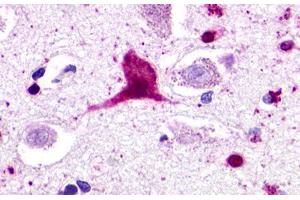 Image no. 1 for anti-G Protein-Coupled Receptor 62 (GPR62) (Cytoplasmic Domain) antibody (ABIN1048850) (GPR62 抗体  (Cytoplasmic Domain))