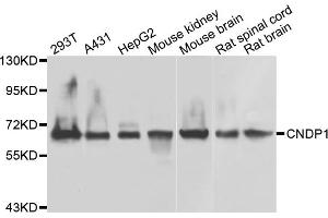 Western blot analysis of extracts of various cell lines, using CNDP1 antibody (ABIN5975565) at 1/1000 dilution. (CNDP1 抗体)