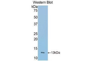 Western Blotting (WB) image for anti-Inducible T-Cell Co-Stimulator (ICOS) (AA 35-131) antibody (ABIN3207897) (ICOS 抗体  (AA 35-131))