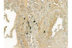 ABIN6259976 and ABIN6277005 at 1/100 staining human normal lung tissue by IHC-P. (APCS 抗体  (Internal Region))