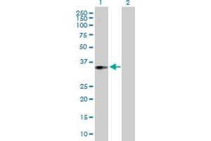 Western Blot analysis of ACOT8 expression in transfected 293T cell line by ACOT8 MaxPab polyclonal antibody. (ACOT8 抗体  (AA 1-319))