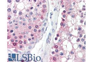 ABIN571107 (5µg/ml) staining of paraffin embedded Human Testis. (DYDC1 抗体  (AA 142-154))