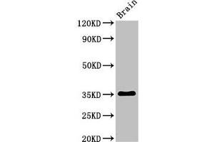 Western Blot Positive WB detected in: Rat brain tissue All lanes: Metrnl antibody at 3 μg/mL Secondary Goat polyclonal to rabbit IgG at 1/50000 dilution Predicted band size: 35, 36 kDa Observed band size: 35 kDa (METRNL 抗体  (AA 46-311))