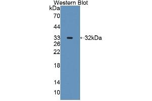 Detection of Recombinant AGXT2, Human using Polyclonal Antibody to Alanine Glyoxylate Aminotransferase 2 (AGXT2) (AGXT2 抗体  (AA 259-514))