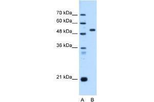 WB Suggested Anti-ST14 Antibody Titration:  0. (ST14 抗体  (C-Term))