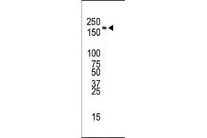 Western blot analysis of anti-INSR Pab in SK-BR-3 cell lysate (Insulin 抗体  (N-Term))