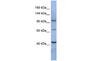 RBM12 antibody used at 1 ug/ml to detect target protein. (RBM12 抗体  (N-Term))