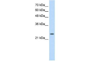 WB Suggested Anti-TNNI1 Antibody Titration:  0. (TNNI1 抗体  (N-Term))