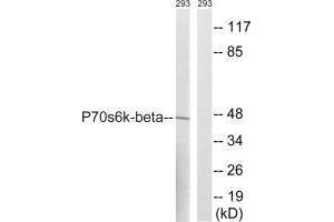 Western blot analysis of extracts from 293 cells, using p70 S6 Kinase β (Ab-423) antibody. (RPS6KB2 抗体  (Ser423))