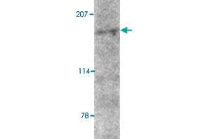 Western blot analysis of AMBRA1 in mouse brain tissue lysate with AMBRA1 polyclonal antibody  at 2 ug/mL . (AMBRA1 抗体  (N-Term))