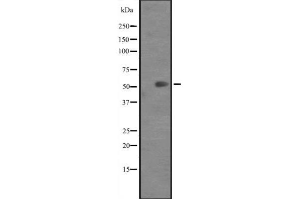 Keratin 82 anticorps  (C-Term)