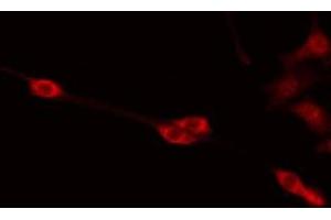 ABIN6275368 staining Hela by IF/ICC. (PABPC5 抗体  (Internal Region))