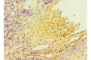 Immunohistochemistry (IHC) image for anti-Telomeric Repeat Binding Factor 2, Interacting Protein (TERF2IP) (AA 1-280) antibody (ABIN7171737)
