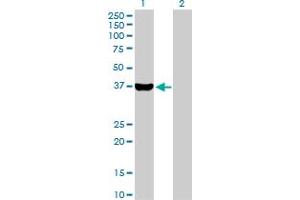 Western Blot analysis of AKR1C4 expression in transfected 293T cell line by AKR1C4 MaxPab polyclonal antibody. (AKR1C4 抗体  (AA 1-323))