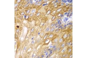 Immunohistochemistry of paraffin-embedded human esophagus using Cyclin D1 antibody (ABIN6127677, ABIN6138079, ABIN6138081 and ABIN6213800) at dilution of 1:100 (40x lens). (Cyclin D1 抗体  (AA 96-295))