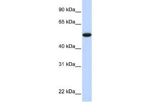 WB Suggested Anti-C9orf43 Antibody Titration: 0. (C9orf43 抗体  (Middle Region))