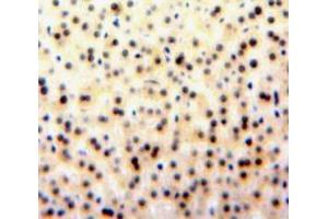 Used in DAB staining on fromalin fixed paraffin-embedded Liver tissue (GATA1 抗体  (AA 20-265))