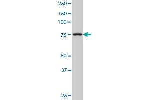 TGM2 monoclonal antibody (M02), clone 1A8. (Transglutaminase 2 抗体  (AA 1-120))