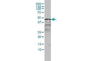 RARA monoclonal antibody (M01), clone 2C9-1F8 Western Blot analysis of RARA expression in A-431 .