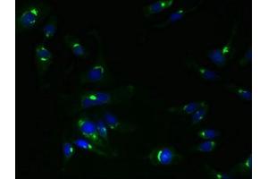 Immunofluorescent analysis of Hela cells using ABIN7173035 at dilution of 1:100 and Alexa Fluor 488-congugated AffiniPure Goat Anti-Rabbit IgG(H+L) (TMEM115 抗体  (AA 187-351))