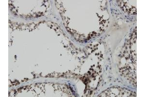 Immunoperoxidase of monoclonal antibody to PBK on formalin-fixed paraffin-embedded human testis. (PBK 抗体  (AA 1-110))