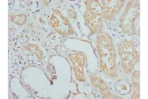 Immunohistochemistry of paraffin-embedded human kidney tissue using ABIN7155677 at dilution of 1:100 (DLX2 抗体  (AA 1-140))