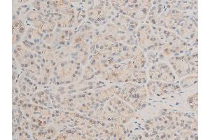 Immunohistochemistry (IHC) image for anti-Mitogen-Activated Protein Kinase Kinase Kinase 7 (MAP3K7) (pThr187) antibody (ABIN6256492)