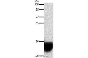 Western blot analysis of Human fetal brain tissue, using GPM6A Polyclonal Antibody at dilution of 1:1050 (GPM6A 抗体)