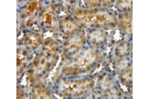 Used in DAB staining on fromalin fixed paraffin-embedded kidney tissue (CLIC4 抗体  (AA 104-253))