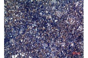 Immunohistochemistry (IHC) analysis of paraffin-embedded Human Tonsils, antibody was diluted at 1:100. (ICOS 抗体)